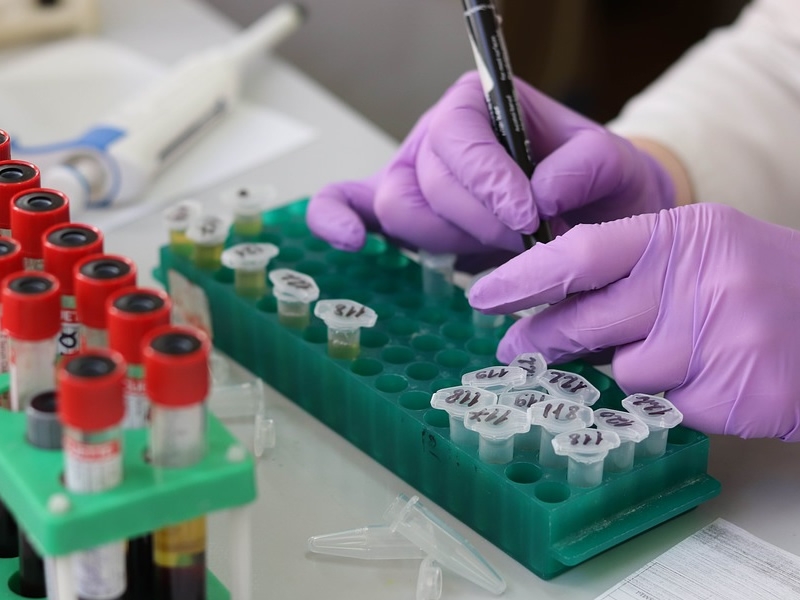 lab tech with purple gloves writing on test tubes with tray of tubes on table