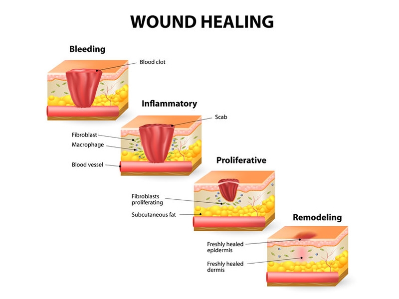 SkinWoundHealingProcess.jpg | Foundation for Alternative and ...