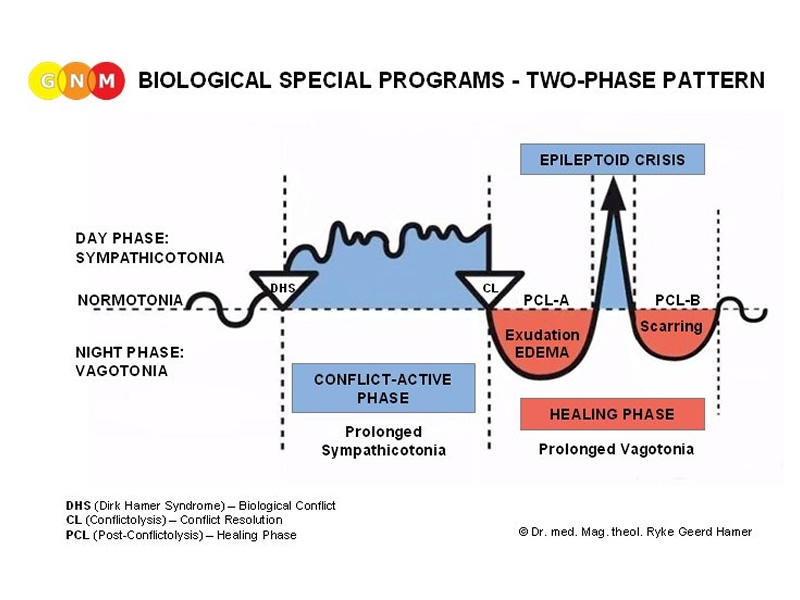 Illustration of Dr. Hamer's Two Phase Pattern