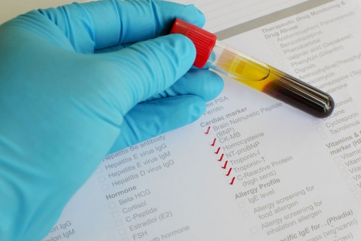 test tube of blood and paperwork for cardiac blood test